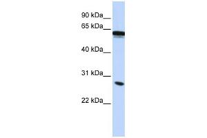 WB Suggested Anti-IGSF1 Antibody Titration:  0. (IGSF1 Antikörper  (Middle Region))
