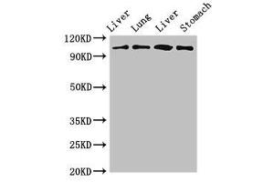 Western Blot Positive WB detected in: Rat liver tissue, Rat lung tissue, Mouse liver tissue, Mouse stomach tissue All lanes: MAP3K13 antibody at 3 μg/mL Secondary Goat polyclonal to rabbit IgG at 1/50000 dilution Predicted band size: 109, 18, 93, 86, 15 kDa Observed band size: 109 kDa (MAP3K13 Antikörper  (AA 506-835))