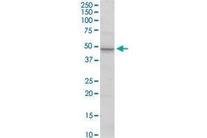 Western Blotting (WB) image for anti-Matrix Metallopeptidase 3 (Stromelysin 1, Progelatinase) (MMP3) (AA 1-477) antibody (ABIN948136)