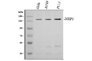 Western blot analysis of Neuropilin 1/NRP1 using anti-Neuropilin 1/NRP1 antibody (ABIN7601963).