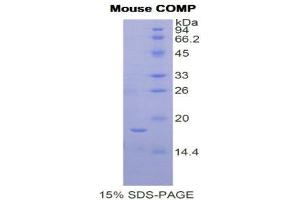SDS-PAGE (SDS) image for Cartilage Oligomeric Matrix Protein (COMP) (AA 317-455) protein (His tag) (ABIN1877501)