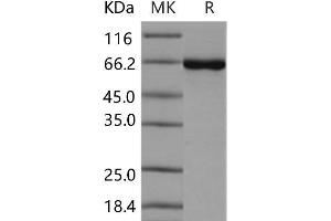 Western Blotting (WB) image for Casein Kinase 2 alpha 1 (CSNK2A1) (Active) protein (GST tag,His tag) (ABIN7320004)