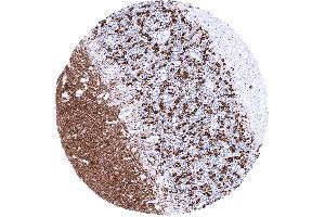 Cerebellum molecular granular and Purkinje layers white matter Synaptophysin is strongly expressed in cerebellum molecular Purkinje and granular layer (Rekombinanter Synaptophysin Antikörper  (AA 274-313))