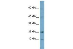 Image no. 1 for anti-Developmental Pluripotency Associated 5 (DPPA5) (N-Term) antibody (ABIN6741859) (DPPA5 Antikörper  (N-Term))