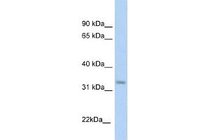 WB Suggested Anti-KHK Antibody  Titration: 1 ug/ml Positive Control: Fetal liver cell lysate (Ketohexokinase Antikörper  (C-Term))