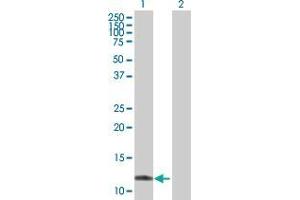Western Blot analysis of TTLL3 expression in transfected 293T cell line by TTLL3 MaxPab polyclonal antibody. (TTLL3 Antikörper  (AA 1-101))