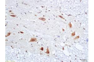 Formalin-fixed and paraffin embedded rat spinal cord labeled with Anti-PMP22 Polyclonal Antibody, Unconjugated  at 1:200 followed by conjugation to the secondary antibody and DAB staining