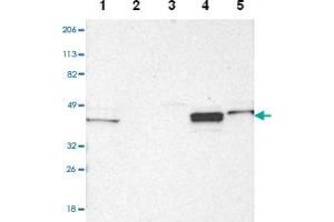 Western blot analysis of Lane 1: Human cell line RT-4, Lane 2: Human cell line U-251MG sp, Lane 3: Human cell line A-431, Lane 4: Human liver tissue, Lane5: Human tonsil tissue with NDRG2 polyclonal antibody  at 1:2500-1:5000 dilution. (NDRG2 Antikörper)