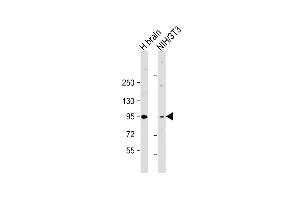 All lanes : Anti-PRKD2 Antibody (Center) at 1:2000 dilution Lane 1: human brain lysate Lane 2: NIH/3T3 whole cell lysate Lysates/proteins at 20 μg per lane.