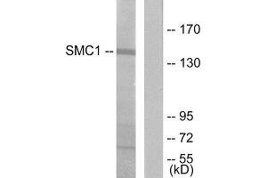 Western blot analysis of extracts from 293 cells, treated with UV (15mins), using SMC1 (epitope around residue 957) antibody. (SMC1A Antikörper  (Ser957))