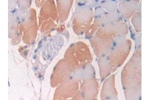 Detection of OPTN in Mouse Skeletal muscle Tissue using Polyclonal Antibody to Optineurin (OPTN) (OPTN Antikörper  (AA 1-300))