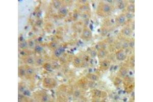 Used in DAB staining on fromalin fixed paraffin-embedded Liver tissue