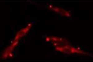 ABIN6275717 staining  HepG2 cells by IF/ICC. (TAZ Antikörper  (Internal Region))