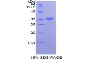 SDS-PAGE analysis of Mouse RELB Protein. (RELB Protein)