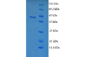 SDS-PAGE (SDS) image for Sterol Carrier Protein 2 (SCP2) (AA 1-143) protein (GST tag) (ABIN5710318)