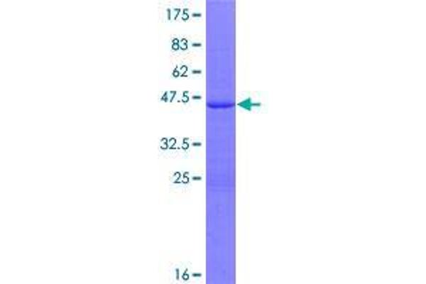 SP140 Protein (AA 1-172) (GST tag)