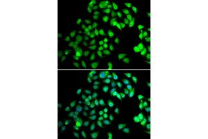 Immunofluorescence analysis of MCF-7 cells using NCBP2 antibody (ABIN5974395). (NCBP2 Antikörper)