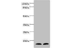 Western blot All lanes: Protachykinin-1 antibody at 6 μg/mL Lane 1: Mouse liver tissue Lane 2: 293T whole cell lysate Secondary Goat polyclonal to rabbit IgG at 1/10000 dilution Predicted band size: 16, 14, 12 kDa Observed band size: 16 kDa (TAC1 Antikörper  (AA 1-129))