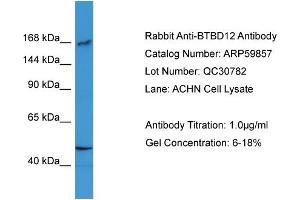 WB Suggested Anti-BTBD12  Antibody Titration: 0. (BTBD12 Antikörper  (N-Term))