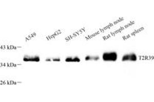 Western blot analysis of TAS2R39 (ABIN7075834) at dilution of 1: 600
