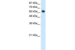 Western Blotting (WB) image for anti-Forkhead Box G1 (FOXG1) antibody (ABIN2461750) (FOXG1 Antikörper)