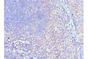 Immunohistochemistry of paraffin-embedded human tonsil tissue using ABIN7148758 at dilution of 1:100 (Cullin 5 Antikörper  (AA 1-300))