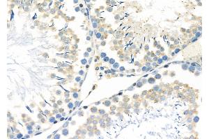 ABIN6257182 and ABIN6273598 at 1/100 staining Rat testis tissue by IHC-P.