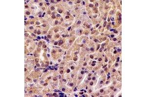 Immunohistochemical analysis of ABAT staining in rat kidney formalin fixed paraffin embedded tissue section.