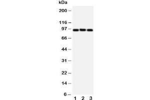 Western blot testing of ABCB6 antibody and Lane 1:  HeLa;  2: MCF-7;  3: A549 cell lysate.