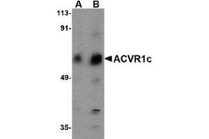 Western blot analysis of ACVR1C in human placenta tissue lysate with AP30016PU-N ACVR1C antibody at (A) 1 and (B) 2 μg/ml. (ACVR1C/ALK7 Antikörper  (N-Term))