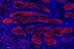 Immunofluorescent analysis of paraformaldehyde-fixed mouse uterus using,NCKAP1 (ABIN7074784) at dilution of 1: 1000 (NCKAP1 Antikörper)
