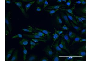 Immunofluorescence of purified MaxPab antibody to SMN2 on HeLa cell. (SMN2 Antikörper  (AA 1-282))
