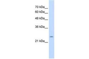 Image no. 1 for anti-Cysteine-Rich Hydrophobic Domain 1 (CHIC1) (AA 81-130) antibody (ABIN205066) (CHIC1 Antikörper  (AA 81-130))