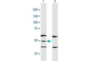 Adenylosuccinate Lyase Antikörper  (AA 1-484)