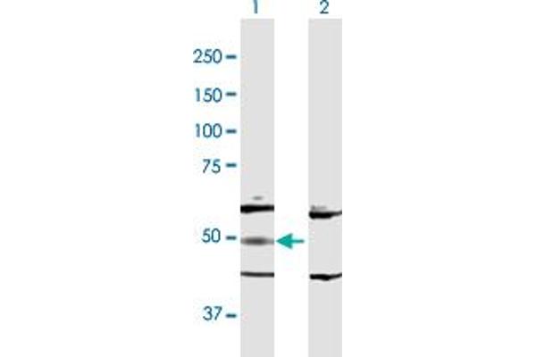 Adenylosuccinate Lyase Antikörper  (AA 1-484)