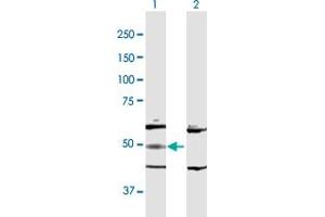Western Blot analysis of ADSL expression in transfected 293T cell line by ADSL MaxPab polyclonal antibody. (Adenylosuccinate Lyase Antikörper  (AA 1-484))