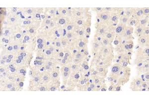 Detection of BGN in Mouse Liver Tissue using Polyclonal Antibody to Biglycan (BGN) (Biglycan Antikörper  (AA 53-166))