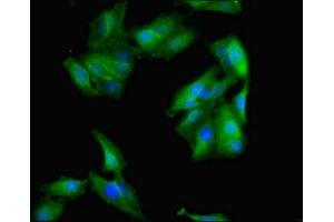 Immunofluorescent analysis of Hela cells using ABIN7142719 at dilution of 1:100 and Alexa Fluor 488-congugated AffiniPure Goat Anti-Rabbit IgG(H+L) (50S Ribosomal Protein L16 (RplP) (AA 1-317) Antikörper)