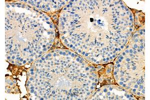 ABIN6263947 and ABIN6272732 at 1/100 staining Mouse testis tissue by IHC-P. (P2RY1 Antikörper  (C-Term))