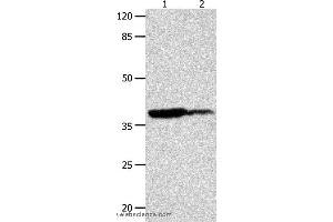 Western blot analysis of Human leiomyosarcoma and liver cancer tissue  , using LPAR4 Polyclonal Antibody at dilution of 1:450 (LPAR4 Antikörper)