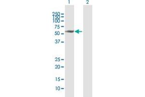 Western Blot analysis of MMP13 expression in transfected 293T cell line by MMP13 MaxPab polyclonal antibody. (MMP13 Antikörper  (AA 1-471))