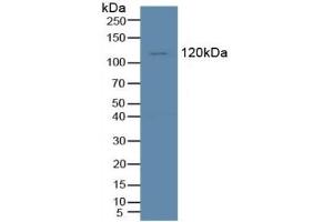 Detection of Tie1 in Human K562 Cells using Polyclonal Antibody to Tyrosine Kinase With Immunoglobulin Like And EGF Like Domains Protein 1 (Tie1) (TIE1 Antikörper  (AA 435-609))