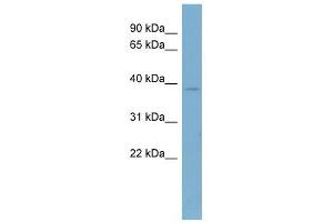 CAB39 antibody used at 1 ug/ml to detect target protein. (CAB39 Antikörper  (Middle Region))
