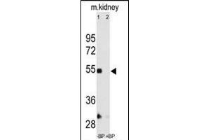 Western Blotting (WB) image for anti-Matrix Metallopeptidase 12 (Macrophage Elastase) (MMP12) (AA 391-420), (C-Term) antibody (ABIN390136)
