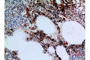 Immunohistochemistry (IHC) analysis of paraffin-embedded Human Lung, antibody was diluted at 1:100. (17beta-HSD4 (N-Term) Antikörper)