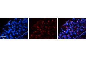 Rabbit Anti-WWP1 Antibody     Formalin Fixed Paraffin Embedded Tissue: Human Pineal Tissue  Observed Staining: Nuclear in pinealocytes  Primary Antibody Concentration: 1:100  Secondary Antibody: Donkey anti-Rabbit-Cy3  Secondary Antibody Concentration: 1:200  Magnification: 20X  Exposure Time: 0. (WWP1 Antikörper  (N-Term))