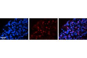 Rabbit Anti-WWP1 Antibody     Formalin Fixed Paraffin Embedded Tissue: Human Pineal Tissue  Observed Staining: Nuclear in pinealocytes  Primary Antibody Concentration: 1:100  Secondary Antibody: Donkey anti-Rabbit-Cy3  Secondary Antibody Concentration: 1:200  Magnification: 20X  Exposure Time: 0.