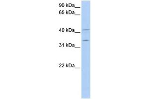 WB Suggested Anti-LASP1 Antibody Titration: 0. (LASP1 Antikörper  (Middle Region))