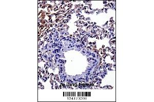 Mouse Hipk4 Antibody immunohistochemistry analysis in formalin fixed and paraffin embedded mouse lung tissue followed by peroxidase conjugation of the secondary antibody and DAB staining. (HIPK4 Antikörper  (C-Term))