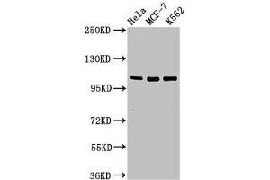 Western Blot Positive WB detected in: Hela whole cell lysate, MCF-7 whole cell lysate, K562 whole cell lysate All lanes: EVC antibody at 2 μg/mL Secondary Goat polyclonal to rabbit IgG at 1/50000 dilution Predicted band size: 112 kDa Observed band size: 112 kDa (EVC Antikörper  (AA 493-602))